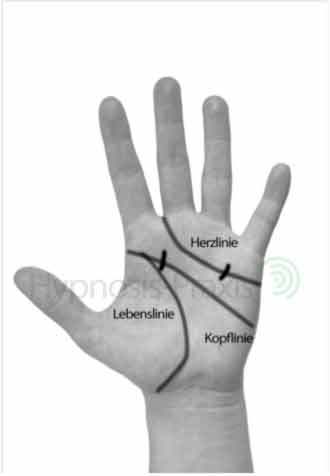 Phobien mit Handflächentherapie behandeln