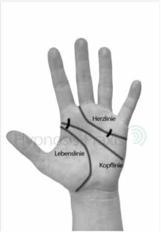 Phobien mit Handflächentherapie behandeln